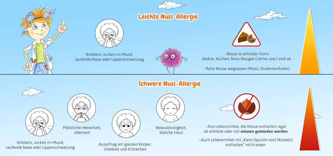 Arten von Nuss-Allergie